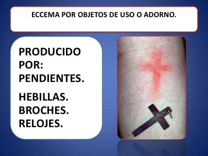 Top el modelo por es americano con la psoriasis