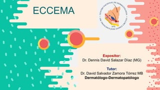 ECCEMA
Expositor:
Dr. Dennis David Salazar Díaz (MG)
Tutor:
Dr. David Salvador Zamora Tórrez MB
Dermatólogo-Dermatopatólogo
 