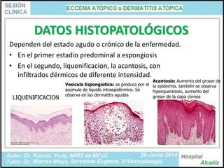 Eccema Atópico = Dermatitis Atópica | PPTX