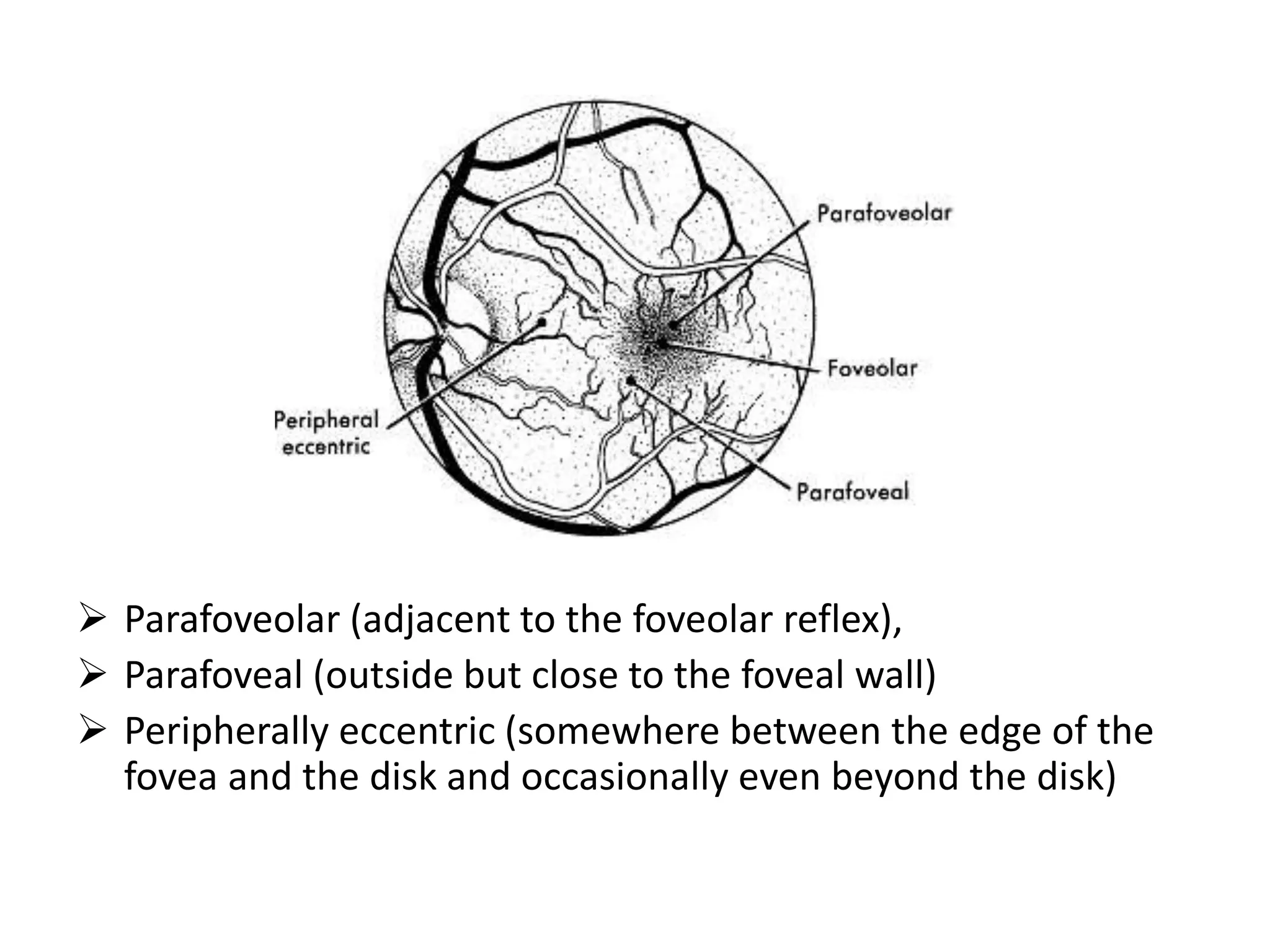  Parafoveolar (adjacent to the foveolar reflex),
 Parafoveal (outside but close to the foveal wall)
 Peripherally eccentric (somewhere between the edge of the
fovea and the disk and occasionally even beyond the disk)
 