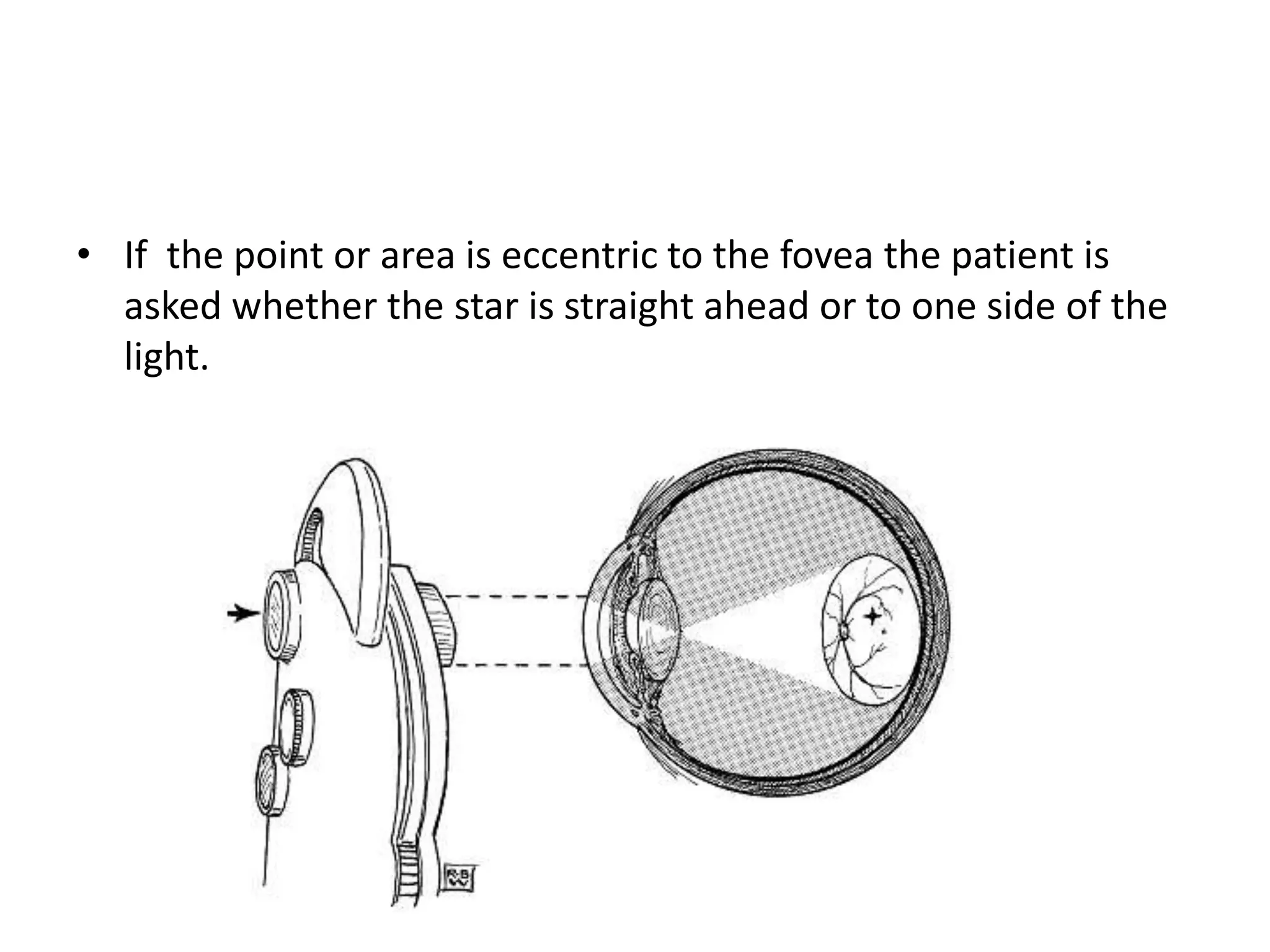 • If the point or area is eccentric to the fovea the patient is
asked whether the star is straight ahead or to one side of the
light.
 