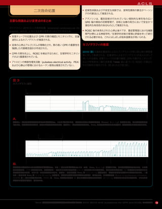 『AHA 心肺蘇生と救急心血管治療のためのガイドライン 2010（2010 AHA Guidelines for CPR and ECC）』のハイライト 13
二次救命処置
主要な問題および変更点のまとめ
ガイドライン 2010 の二次救命処置（advanced cardiovascular life
support，ACLS）における主要な変更点には以下が含まれる。
• 気管チューブの位置および CPR の質の確認とモニタリングに，定量
波形によるカプノグラフィが推奨される。
• 従来の心停止アルゴリズムが簡略化され，質の高い CPR の重要性を
強調した代替概念設計が作成された。
• CPR の質を向上し，ROSC を検出するために，生理学的モニタリン
グがより重要視されている。
• アトロピンの無脈性電気活動（pulseless electrical activity，PEA）
および心静止の管理におけるルーチン使用は推奨されていない。
• 症候性徐脈および不安定な徐脈では，変時性薬剤の静注がペーシン
グの代替法として推奨される。
• アデノシンは，鑑別診断が行われていない規則的な単形性の広い
QRS 幅の頻拍の初期管理で，診断と治療の両方において安全かつ
潜在的な有効性のあるものとして推奨される。
• ROSC 後の体系化された心停止後ケアが，重症管理室における複数
専門分野による神経学的／生理学的状態の管理と評価を伴って続行
される必要がある。これにはしばしば低体温療法が用いられる。
カプノグラフィの推奨
2010（新）：連続定量波形によるカプノグラフィが周心停止期の挿管患
者に対して推奨される。定量波形によるカプノグラフィが成人に対して
用いられる場合，気管チューブの位置の確認，CPR の質のモニタリング，
および呼気終末二酸化炭素量 Petco2 値に基づいた ROSC の検出に
対する勧告が適用される（図 3A および図 3B）。
A C L S
50
37.5
25
12.5
0
mmHg
挿管前 挿管中
1 分間隔
A.
気管チューブの位置を確認するためのカプノグラフィ。このカプノグラムは，挿管時の呼気二酸化炭素分圧（Petco2）（mm Hg）を縦軸として，その経時変化を示
している。患者が挿管されると，呼気二酸化炭素が検出され，気管チューブの位置を確認する。Petco2 は呼吸サイクルの間に変動し，呼気終末期に最高の値になる。
50
37.5
25
12.5
0
mmHg
CPR ROSC
1 分間隔
B.
蘇生努力の効果をモニタリングするカプノグラフィ。この 2 番目のカプノグラフィトレースは，Petco2（mm Hg）を縦軸として，その経時変化を示している。この患
者は挿管され，CPR を受けている。換気速度は 1 分あたりの人工呼吸が約 8 ∼ 10 回であることに注意する。胸骨圧迫は連続して 100 回／分よりやや速いテン
ポで行われているが，このトレースには現れていない。最初の 1 分間は初期 Petco2 が 12.5 mm Hg 未満であり，血流量が非常に少ないことを示している。2 分
目と 3 分目には Petco2 が 12.5 ∼ 25 mm Hg に増加し，進行中の蘇生に伴う血流量の増大と一致している。自己心拍再開（return of spontaneous circulation，
ROSC）は 4 分目に発現している。ROSC は，Petco2 が急峻に増大し（4 本目の縦線の直後にみられる）40 mm Hg を超えたことにより認識され，このことは
血流量の大幅な改善と一致している。
図 3
カプノグラフィ波形
 
