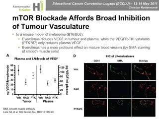 mTOR Blockade Affords Broad Inhibition of Tumour VasculatureIn a mouse model of melanoma (B16/BL6):Everolimus reduces VEGF in tumour and plasma, while the VEGFR-TKI vatalanib (PTK787) only reduces plasma VEGFEverolimus has a more profound effect on mature blood vessels (by SMA staining of smooth muscle cells)  SMA, smooth muscle antibody.Lane HA, et al. Clin Cancer Res. 2009;15:1612-22.