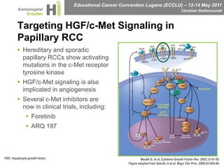 Targeting HGF/c-Met Signaling in Papillary RCCHereditary and sporadic papillary RCCs show activating mutations in the c-Met receptor tyrosine kinase HGF/c-Met signaling is also implicated in angiogenesisSeveral c-Met inhibitors are now in clinical trials, including:ForetinibARQ 197 HGF, hepatocyte growth factor.Maulik G, et al. Cytokine Growth Factor Rev. 2002;13:41-59.Figure adapted from Sekulic A et al. Mayo Clin Proc. 2008;83:825-46.