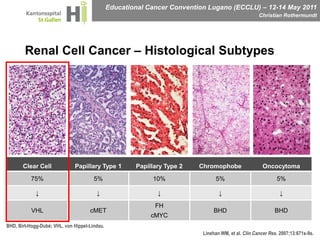 Renal Cell Cancer – Histological SubtypesBHD, Birt-Hogg-Dubé; VHL, von Hippel-Lindau.Linehan WM, et al. Clin Cancer Res. 2007;13:671s-9s.