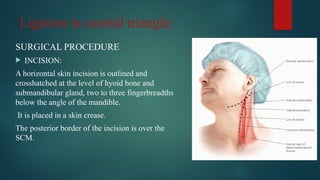 External carotid artery and its ligationPPT.pptx