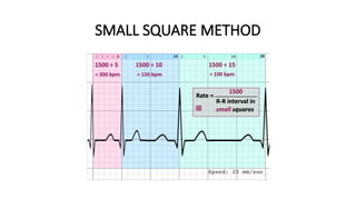 Early Clinical Exposure first year MBBS-ECG.pptx