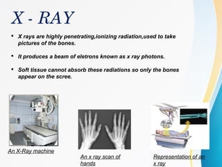 X - RAY
 X rays are highly penetrating,ionizing radiation,used to take
pictures of the bones.
 It produces a beam of eletrons known as x ray photons.
 Soft tissue cannot absorb these radiations so only the bones
appear on the scree.
An X-Ray machine
An x ray scan of
hands
Representation of an
x ray
 