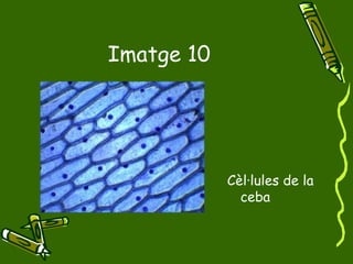 Imatge 10 Cèl·lules de la ceba 