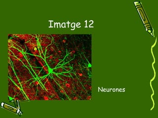 Imatge 12 Neurones 