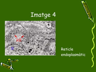 Imatge 4 Reticle endoplasmàtic 