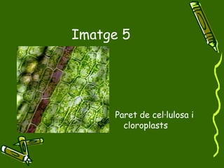 Imatge 5 Paret de cel·lulosa i cloroplasts 