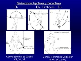 Central terminal de Wilson: VR, VL, VF Central terminal de Golberger (aVR, aVL, aVF) D 1 D 2 D 3 Einthoven Derivaciones bipolares y monoplares 