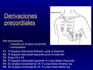 Son derivaciones situadas en el plano horizontal  monopolares V1 :  4º Espacio Intercostal Derecho  junto al esternón V2 :  4º Espacio Intercostal Izquierdo junto al esternón V3 :  Entre V2 y V4 V4 :  5º Espacio Intercostal Izquierdo    Linea Medio Clavicular V5 :  En el plano horizontal de V4    Linea Axilar Anterior Izq.  V6 :  En el plano horizontal de V4    Linea Axilar Media Izq.  Derivaciones precordiales Ángulo de Louis 
