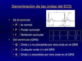 Denominación de las ondas del ECG De la aurícula : P : la normal F : Flutter auricular f : fibrilación auricular Del ventrículo  (QRS): Q : Onda (-) no precedida por otra onda en el QRS R : Cualquier onda (+) del QRS S : Onda (-) precedida por otra onda en el QRS 