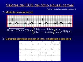 Valores del ECG del ritmo sinusal normal 2.-   Mediante una regla de tres 3.-  Contar los complejos que hay en 10 s. y multiplicar la cifra por 6   Cálculo de la frecuencia cardiaca () 