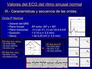 III.- Características y secuencia de las ondas: Delante  del QRS Plano frontal:  ÂP  entre -30º y + 90º Plano horizontal:  (+/-) en V1, (+) en V2-3-4-5-6  Duración :  < 0,10 s (< 2,5 mm) Altura:   < de 0,25 mV (< 2,5 mm) Onda P Normal Valores del ECG del ritmo sinusal normal ÂPd (Eje Auri. dcha.) De arriba abajo De atrás adelante De dcha a izq.  ÂPi (Eje Aurí. izq.)  De dcha. a izqu. De adelante atrás V 1 V 2 V 3 V 4 V 5 V 6 ÂP (Eje de la P)  De arriba abajo De dcha. A izq. De atrás adelante 
