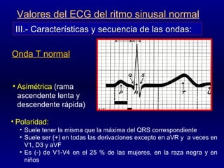 Onda T normal Asimétrica   (rama ascendente lenta y descendente rápida) III.- Características y secuencia de las ondas: Valores del ECG del ritmo sinusal normal Polaridad:   Suele tener la misma que la máxima del QRS correspondiente Suele ser (+) en todas las derivaciones excepto en aVR y  a veces en V1, D3 y aVF Es (-) de V1-V4 en el 25 % de las mujeres, en la raza negra y en niños 