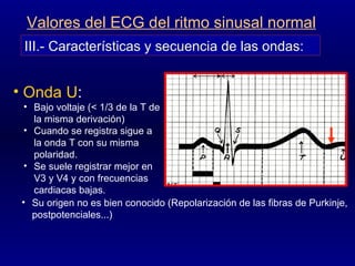 Onda U : Bajo voltaje (< 1/3 de la T de la misma derivación) Cuando se registra sigue a la onda T con su misma polaridad. Se suele registrar mejor en V3 y V4 y con frecuencias cardiacas bajas. III.- Características y secuencia de las ondas: Valores del ECG del ritmo sinusal normal Su origen no es bien conocido (Repolarización de las fibras de Purkinje, postpotenciales...) 