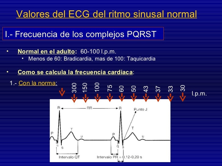 intervalo qt normal ecg intervalo qt normal ecg
