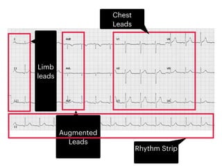 ECG (learning how to write and calculate basics).pdf