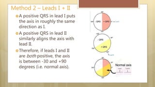 ECG - 1 Toward the Basics | PPTX