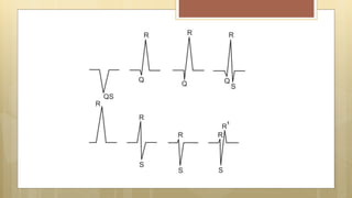 Ecg 1 Toward The Basics