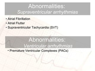 Abnormalities:  Supraventricular arrhythmias Atrial Fibrillation Atrial Flutter  Supraventricular Tachycardia (SVT) Premature Ventricular Complexes (PACs) Abnormalities:  Ventricular arrhythmias 