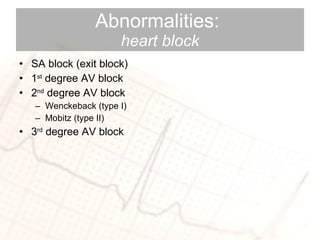 Abnormalities:  heart block SA block (exit block) 1 st  degree AV block 2 nd  degree AV block Wenckeback (type I) Mobitz (type II) 3 rd  degree AV block 