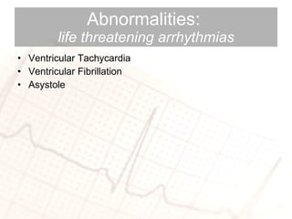 Abnormalities:  life threatening arrhythmias Ventricular Tachycardia Ventricular Fibrillation Asystole 