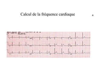 Calcul de la fréquence cardiaque
 