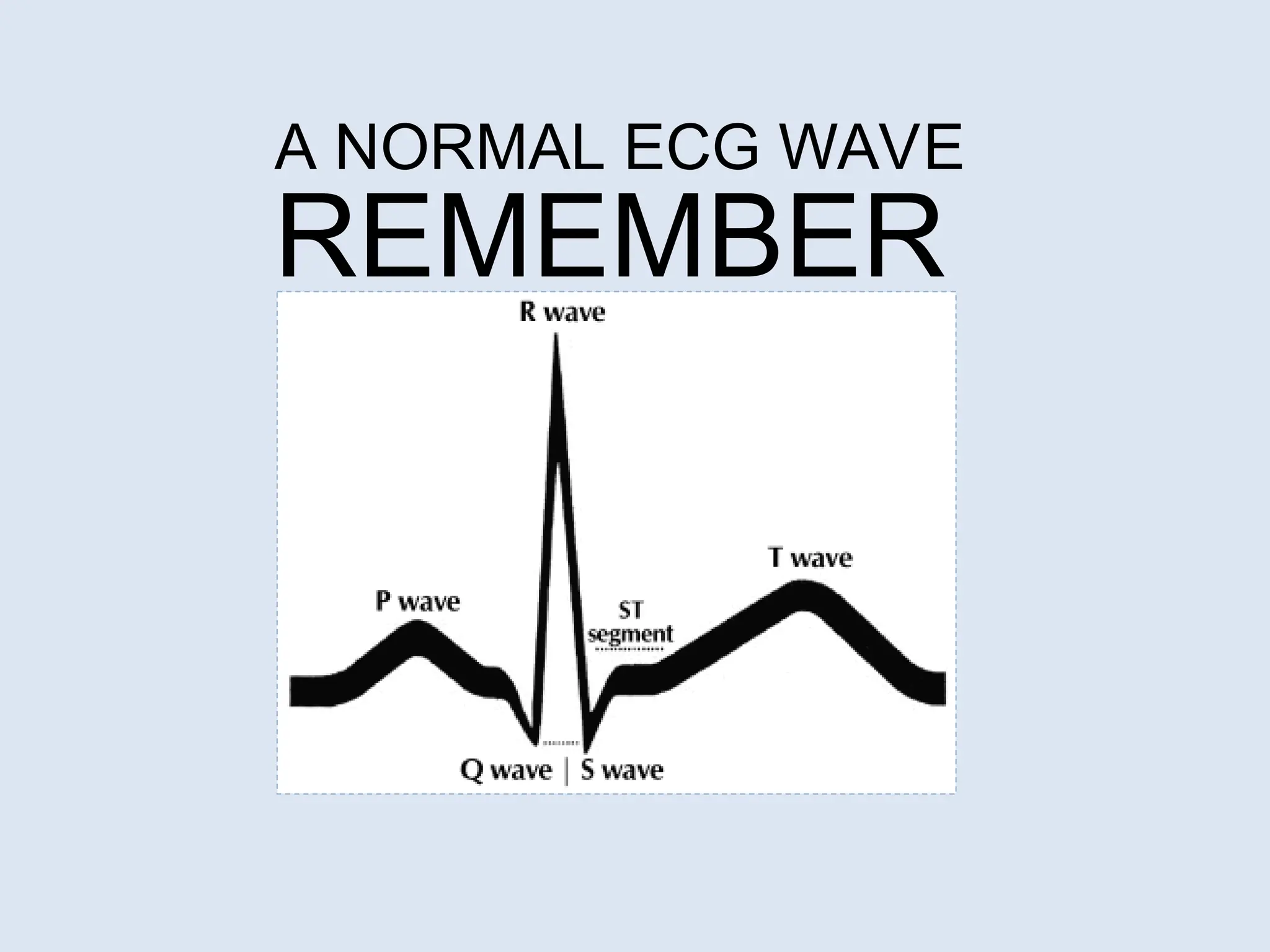 A NORMAL ECG WAVE
REMEMBER
 