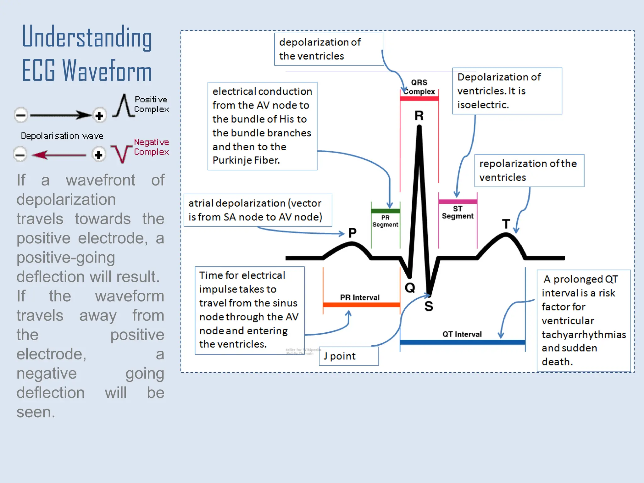 If a wavefront of
depolarization
travels towards the
positive electrode, a
positive-going
deflection will result.
If the waveform
travels away from
the positive
electrode, a
negative going
deflection will be
seen.
Understanding
ECG Waveform
 
