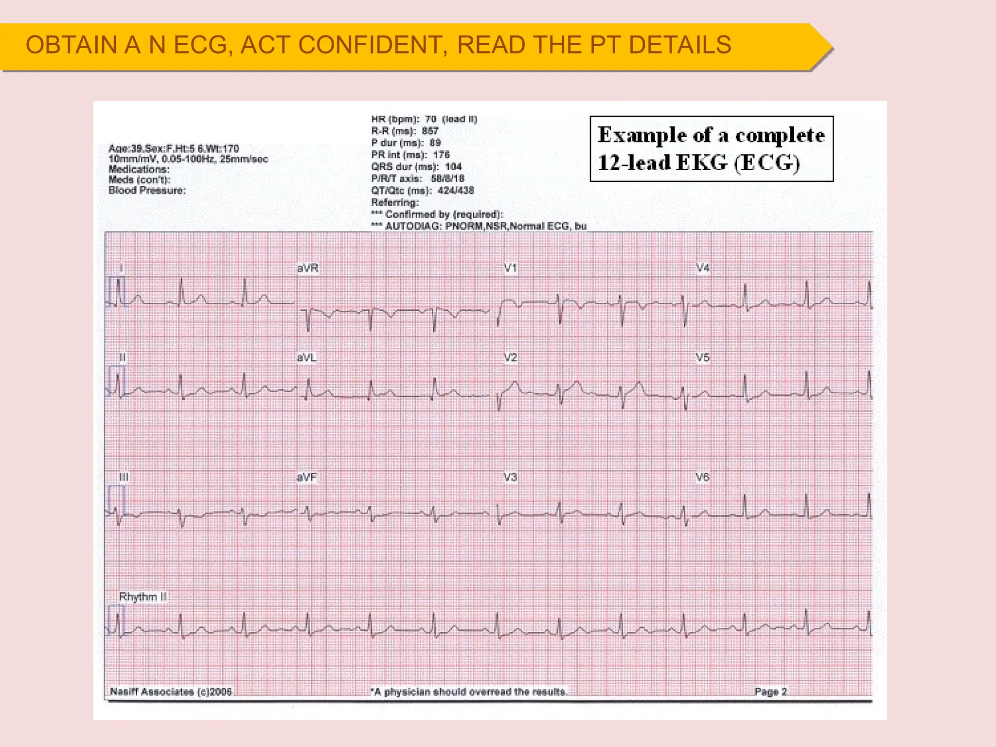 OBTAIN A N ECG, ACT CONFIDENT, READ THE PT DETAILS
 