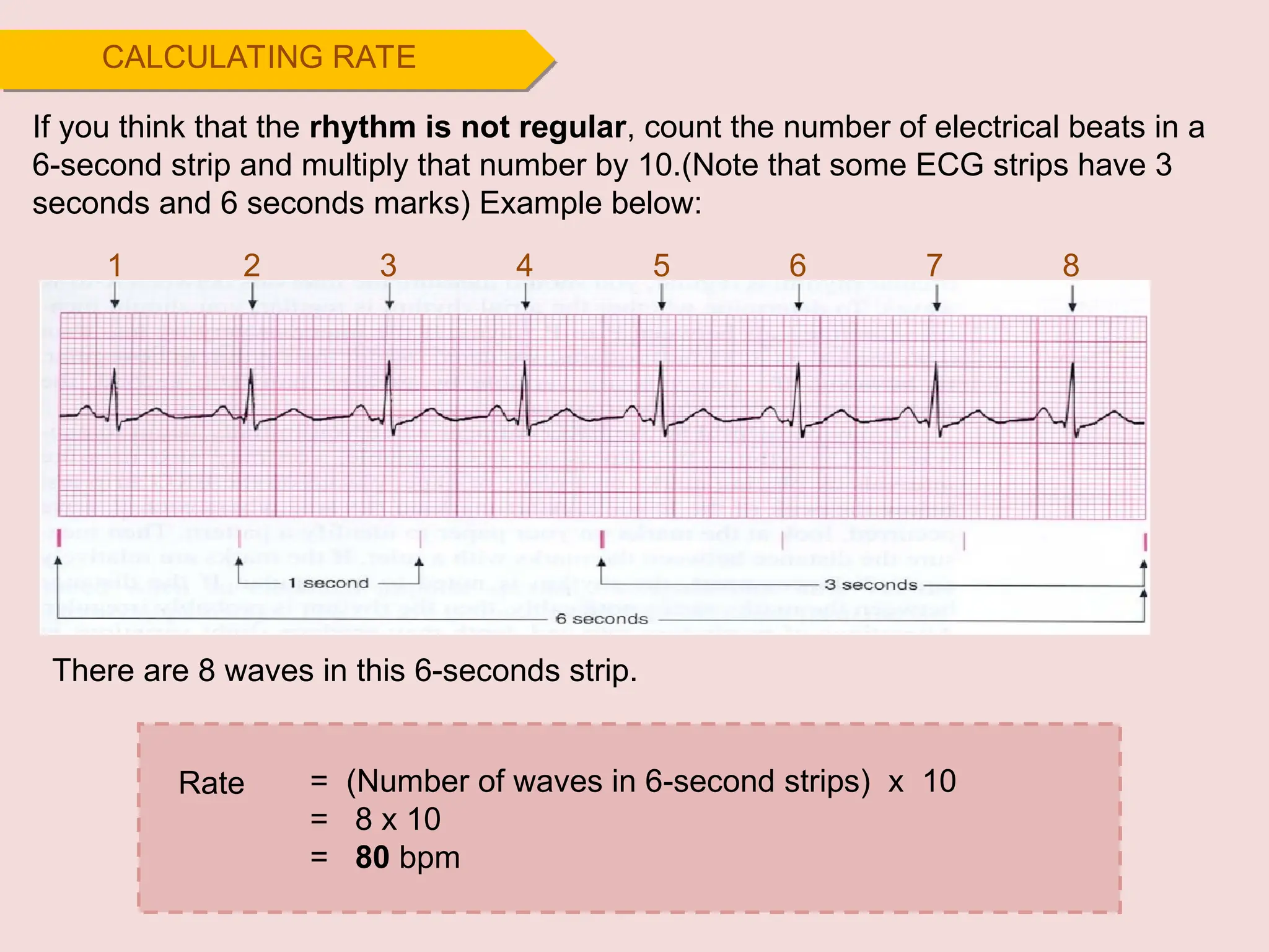 If you think that the rhythm is not regular, count the number of electrical beats in a
6-second strip and multiply that number by 10.(Note that some ECG strips have 3
seconds and 6 seconds marks) Example below:
CALCULATING RATE
1 2 3 4 5 6 7 8
= (Number of waves in 6-second strips) x 10
= 8 x 10
= 80 bpm
Rate
There are 8 waves in this 6-seconds strip.
 