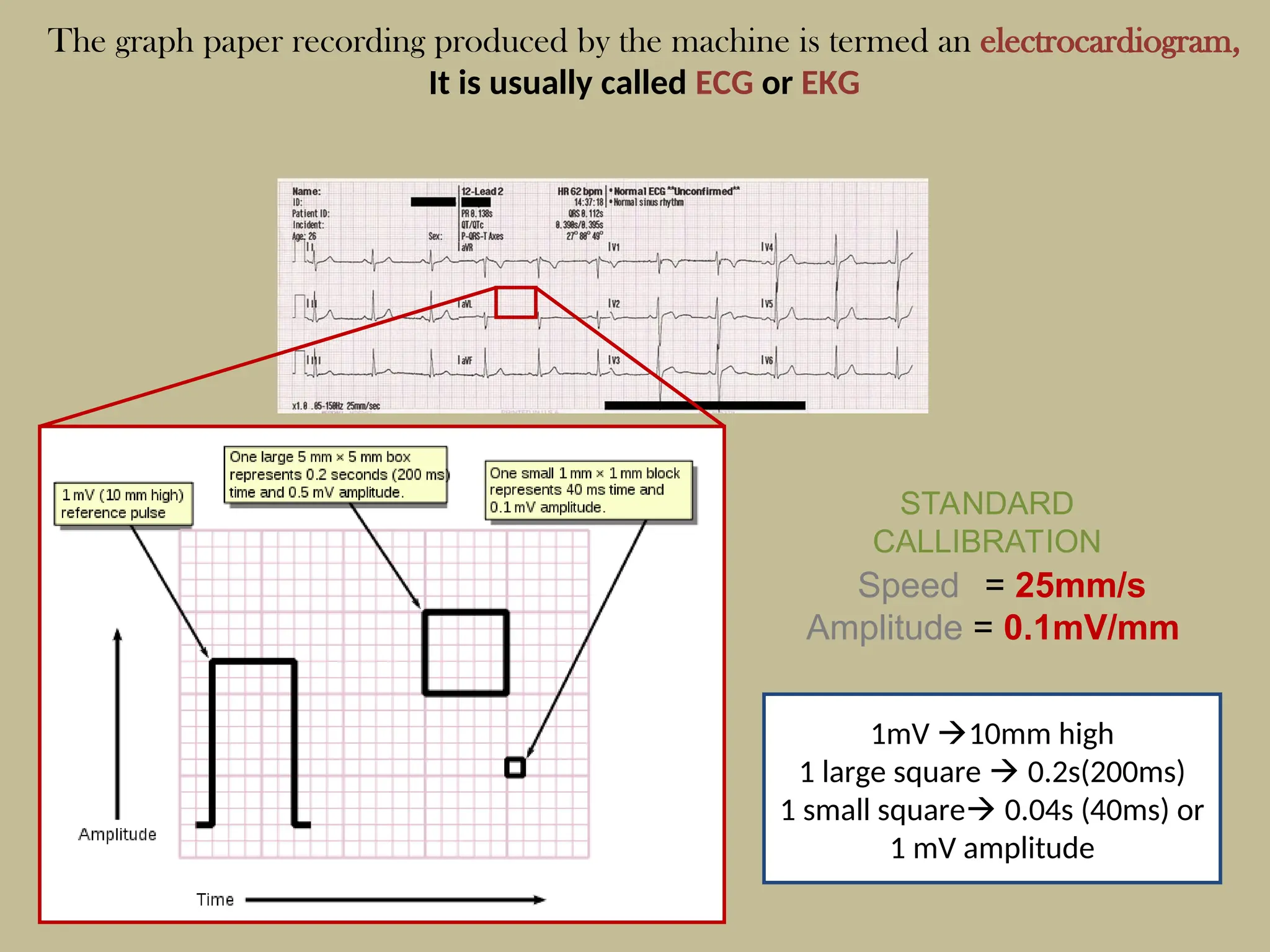 The graph paper recording produced by the machine is termed an electrocardiogram,
It is usually called ECG or EKG
STANDARD
CALLIBRATION
Speed = 25mm/s
Amplitude = 0.1mV/mm
1mV 10mm high
1 large square  0.2s(200ms)
1 small square 0.04s (40ms) or
1 mV amplitude
 