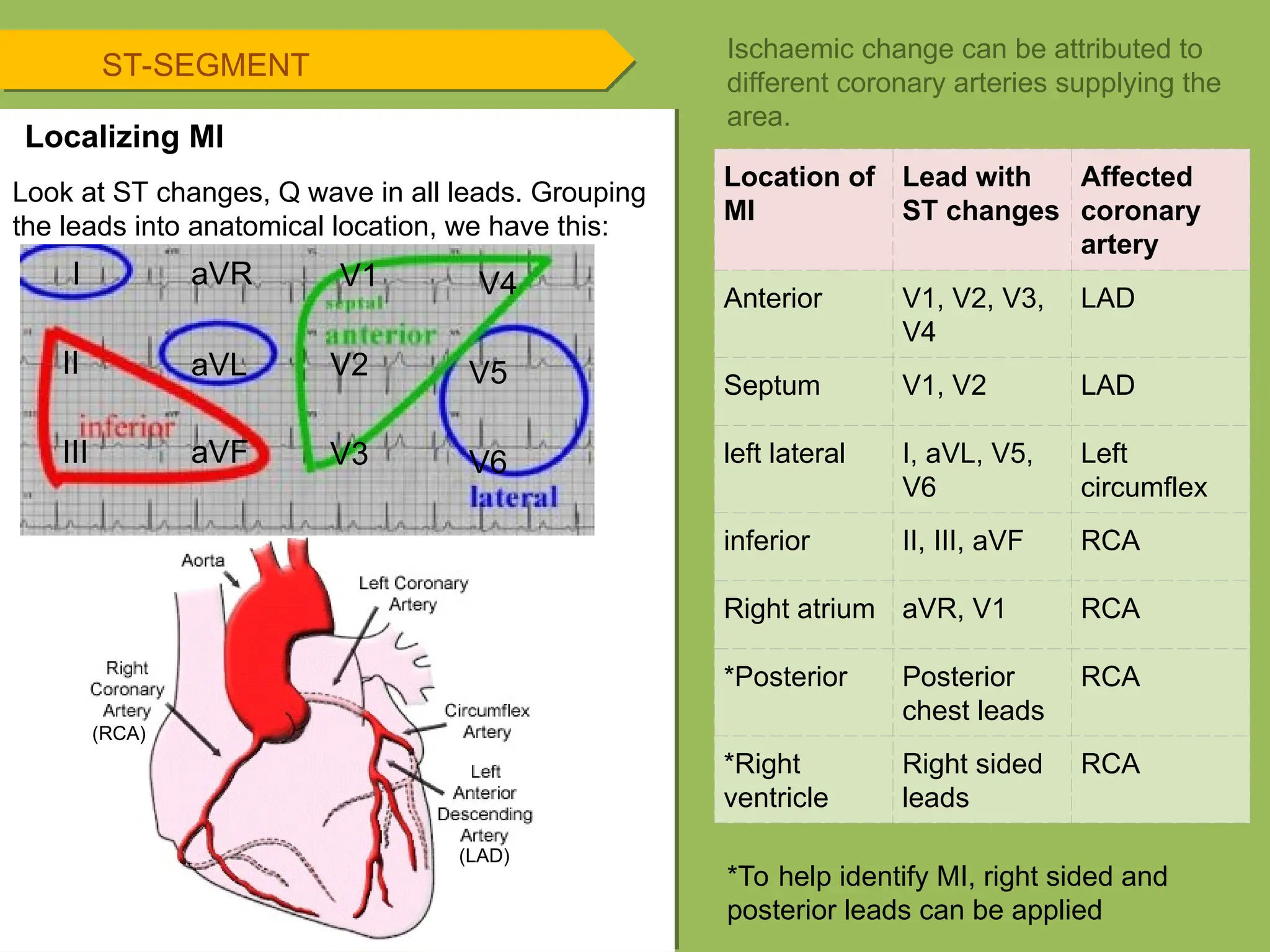 ST-SEGMENT
Look at ST changes, Q wave in all leads. Grouping
the leads into anatomical location, we have this:
Ischaemic change can be attributed to
different coronary arteries supplying the
area.
Location of
MI
Lead with
ST changes
Affected
coronary
artery
Anterior V1, V2, V3,
V4
LAD
Septum V1, V2 LAD
left lateral I, aVL, V5,
V6
Left
circumflex
inferior II, III, aVF RCA
Right atrium aVR, V1 RCA
*Posterior Posterior
chest leads
RCA
*Right
ventricle
Right sided
leads
RCA
*To help identify MI, right sided and
posterior leads can be applied
Localizing MI
I
II
III
aVR
aVL
aVF
V1
V2
V3
V4
V5
V6
(LAD)
(RCA)
 