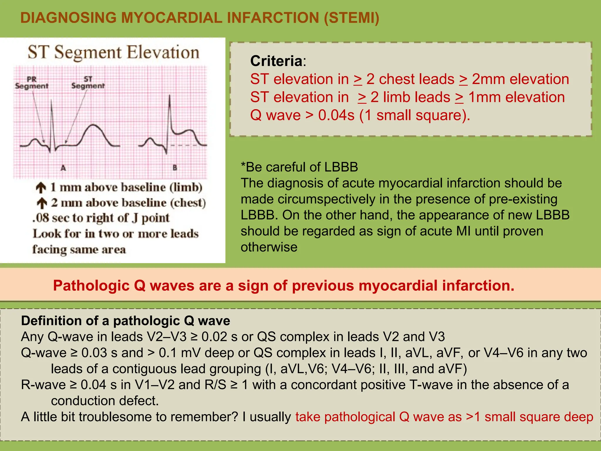 Criteria:
ST elevation in > 2 chest leads > 2mm elevation
ST elevation in > 2 limb leads > 1mm elevation
Q wave > 0.04s (1 small square).
*Be careful of LBBB
The diagnosis of acute myocardial infarction should be
made circumspectively in the presence of pre-existing
LBBB. On the other hand, the appearance of new LBBB
should be regarded as sign of acute MI until proven
otherwise
DIAGNOSING MYOCARDIAL INFARCTION (STEMI)
Definition of a pathologic Q wave
Any Q-wave in leads V2–V3 ≥ 0.02 s or QS complex in leads V2 and V3
Q-wave ≥ 0.03 s and > 0.1 mV deep or QS complex in leads I, II, aVL, aVF, or V4–V6 in any two
leads of a contiguous lead grouping (I, aVL,V6; V4–V6; II, III, and aVF)
R-wave ≥ 0.04 s in V1–V2 and R/S ≥ 1 with a concordant positive T-wave in the absence of a
conduction defect.
A little bit troublesome to remember? I usually take pathological Q wave as >1 small square deep
Pathologic Q waves are a sign of previous myocardial infarction.
 