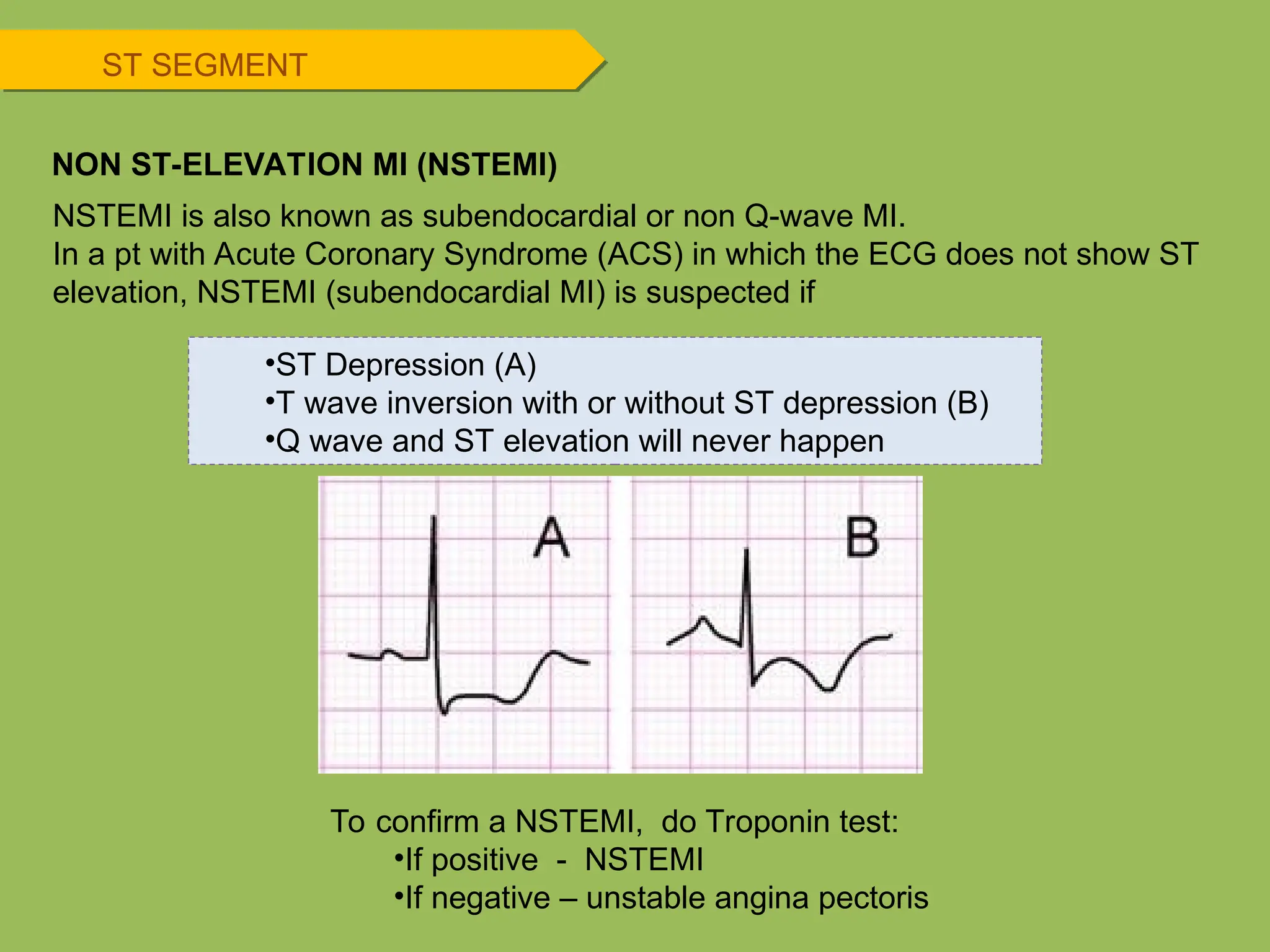 NSTEMI is also known as subendocardial or non Q-wave MI.
In a pt with Acute Coronary Syndrome (ACS) in which the ECG does not show ST
elevation, NSTEMI (subendocardial MI) is suspected if
ST SEGMENT
NON ST-ELEVATION MI (NSTEMI)
•ST Depression (A)
•T wave inversion with or without ST depression (B)
•Q wave and ST elevation will never happen
To confirm a NSTEMI, do Troponin test:
•If positive - NSTEMI
•If negative – unstable angina pectoris
 