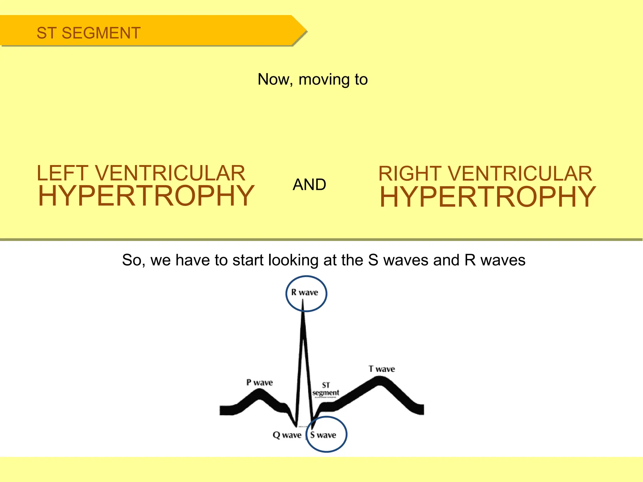 ST SEGMENT
Now, moving to
LEFT VENTRICULAR
HYPERTROPHY
RIGHT VENTRICULAR
HYPERTROPHY
AND
So, we have to start looking at the S waves and R waves
 