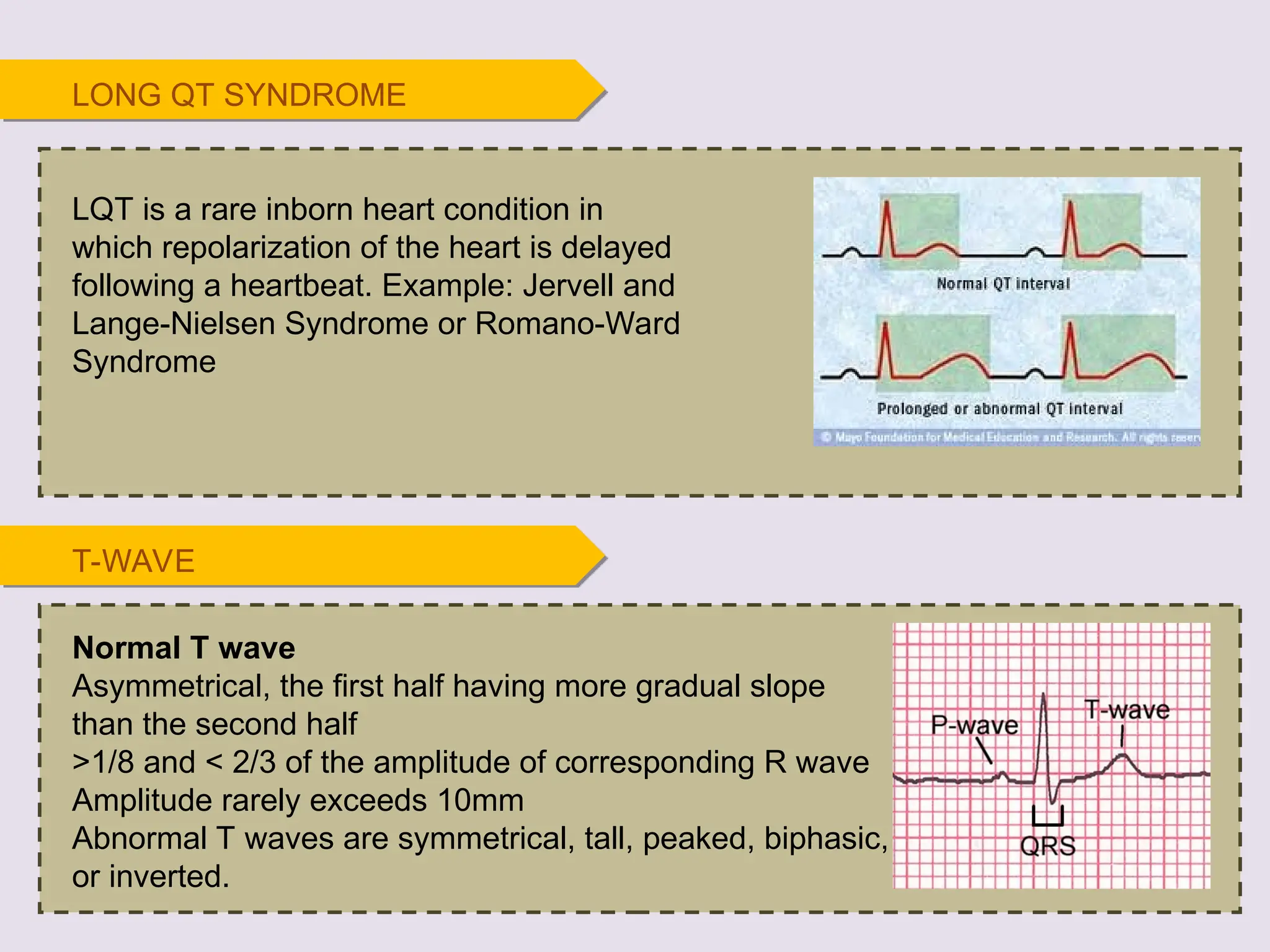 T-WAVE
Normal T wave
Asymmetrical, the first half having more gradual slope
than the second half
>1/8 and < 2/3 of the amplitude of corresponding R wave
Amplitude rarely exceeds 10mm
Abnormal T waves are symmetrical, tall, peaked, biphasic,
or inverted.
LQT is a rare inborn heart condition in
which repolarization of the heart is delayed
following a heartbeat. Example: Jervell and
Lange-Nielsen Syndrome or Romano-Ward
Syndrome
LONG QT SYNDROME
 