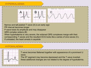 Narrow and tall peaked T wave (A) is an early sign PR interval becomes longer P wave loses its amplitude and may disappear QRS complex widens (B) When hyperkalemia is very severe, the widened QRS complexes merge with their corresponding T waves and the resultant ECG looks like a series of sine waves (C). If untreated, the heart arrests in asystole T wave becomes flattened together with appearance of a prominent U wave. The ST segment may become depressed and the T wave inverted. these additional changes are not related to the degree of hypokalemia. HYPERKALAEMIA HYPOKALAEMIA 
