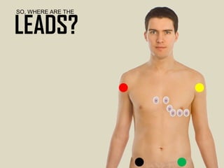 SO, WHERE ARE THE LEADS? 