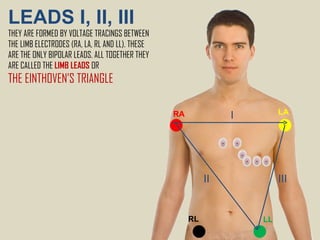 III II LEADS I, II, III  THEY ARE FORMED BY VOLTAGE TRACINGS BETWEEN THE LIMB ELECTRODES (RA, LA, RL AND LL).  THESE ARE THE ONLY BIPOLAR LEADS.  ALL TOGETHER THEY ARE CALLED THE  LIMB LEADS  OR THE EINTHOVEN’S TRIANGLE RA LA RL LL I 