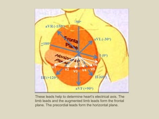 These leads help to determine heart’s electrical axis. The limb leads and the augmented limb leads form the frontal plane. The precordial leads form the horizontal plane.  