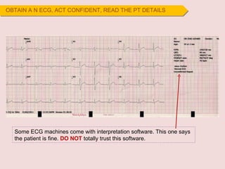 OBTAIN A N ECG, ACT CONFIDENT, READ THE PT DETAILS  Some ECG machines come with interpretation software. This one says the patient is fine.  DO NOT  totally trust this software. 