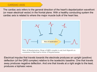 CARDIAC AXIS Electrical impulse that travels towards the electrode produces an upright (positive) deflection (of the QRS complex) relative to the isoelectric baseline. One that travels away produces negative deflection. And one that travels at a right angle to the lead, produces a biphasic wave. The cardiac axis refers to the general direction of the heart's depolarization wavefront (or mean electrical vector) in the frontal plane. With a healthy conducting system the cardiac axis is related to where the major muscle bulk of the heart lies. 