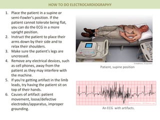 Place the patient in a supine or semi-Fowler's position. If the patient cannot tolerate being flat, you can do the ECG in a more upright position. Instruct the patient to place their arms down by their side and to relax their shoulders. Make sure the patient's legs are uncrossed. Remove any electrical devices, such as cell phones, away from the patient as they may interfere with the machine. If you're getting artifact in the limb leads, try having the patient sit on top of their hands. Causes of artifact: patient movement, loose/defective electrodes/apparatus, improper grounding.  HOW TO DO ELECTROCARDIOGRAPHY An ECG  with artifacts. Patient, supine position 