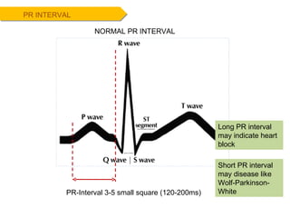 PR INTERVAL NORMAL PR INTERVAL PR-Interval 3-5 small square (120-200ms) Long PR interval may indicate heart block Short PR interval may disease like Wolf-Parkinson-White 
