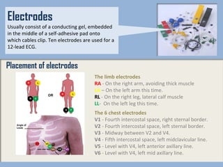 The limb electrodes RA  - On the right arm, avoiding thick muscle LA  – On the left arm this time. RL  - On the right leg, lateral calf muscle LL -  On the left leg this time. The 6 chest electrodes V1  - Fourth intercostal space, right sternal border. V2  - Fourth intercostal space, left sternal border. V3  - Midway between V2 and V4. V4  - Fifth intercostal space, left midclavicular line. V5  - Level with V4, left anterior axillary line. V6  - Level with V4, left mid axillary line. Electrodes Usually consist of a conducting gel, embedded in the middle of a self-adhesive pad onto which cables clip. Ten electrodes are used for a 12-lead ECG. Placement of electrodes 